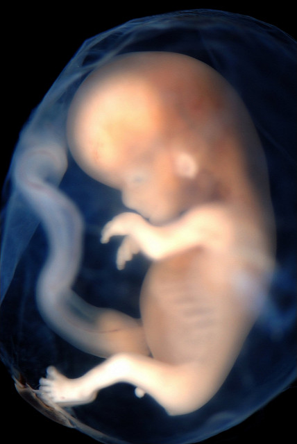 Human Embryo Photo courtesy of lunar caustic / CC 2.0