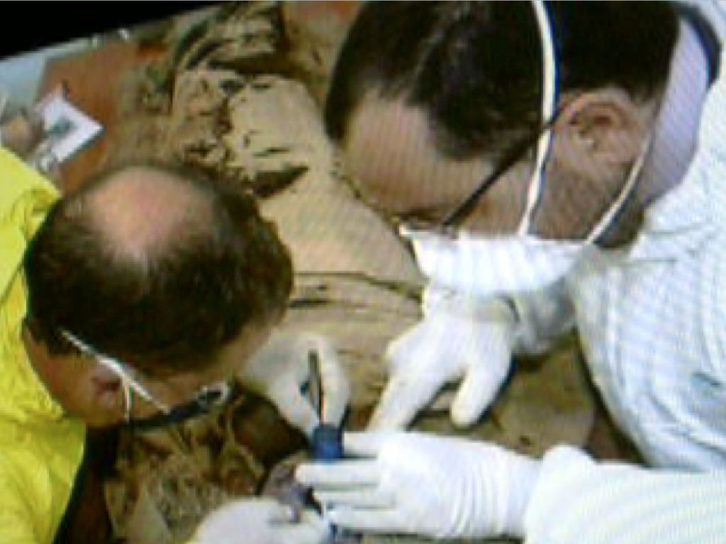 J. J. Borg on the right, sampling the mummy for aDNA, together with forensic pathologist, J. Abela Medici. The wearing caps should be a standard procedure.